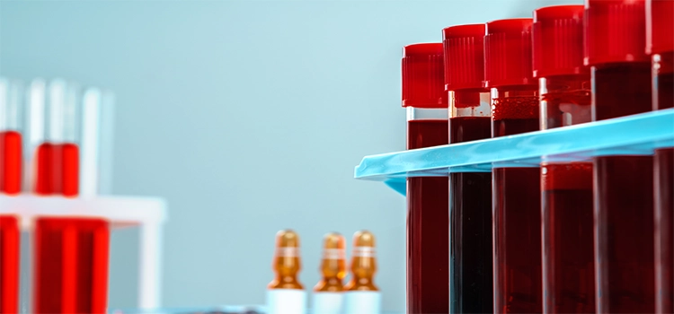 Importance of Order of Draw Blood Bottles – Use and Best Practice